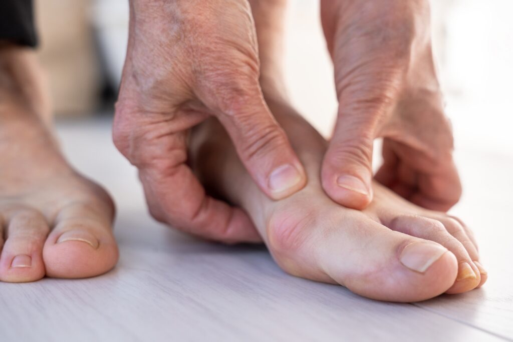 Doctors Highlight A Rare Cancer Symptom That Can Appear On Your Toenails