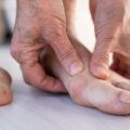 Doctors Highlight A Rare Cancer Symptom That Can Appear On Your Toenails