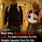 A man who broke his own legs to gain 9 inches reveals his painful transformation.