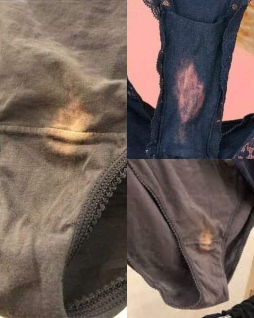 What Those “Bleach” Stains on Your Underwear Really Mean—The Truth Revealed