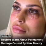 Doctors Warn of Permanent Damage from Beauty Trend That Leaves Skin Looking ‘Reptilian’