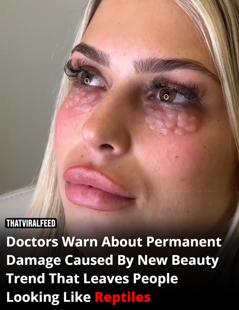 Doctors Warn of Permanent Damage from Beauty Trend That Leaves Skin Looking ‘Reptilian’