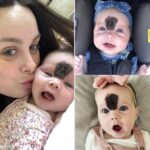 Vienna Brookshaw: The Girl Confidently Accepts Her Unique Birthmark