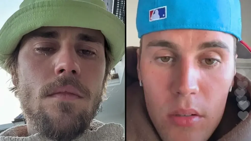 Fans of Justin Bieber express worry as the singer speaks out about “all of the hurt.”