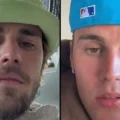 Fans of Justin Bieber express worry as the singer speaks out about “all of the hurt.”