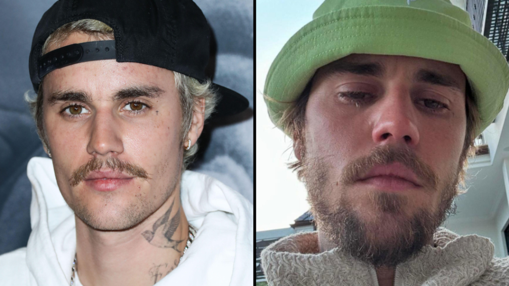 Justin Bieber’s Shocking Diagnosis: ‘Super Silent Disease’ Revealed