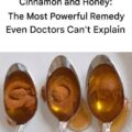 Cinnamon and Honey: The Most Powerful Remedy Even Doctors Can’t Explain