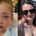 Toddler, 4, Blinded After Biting Common Household Item Mom Gave Her To Hold