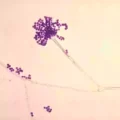 Deadly Airborne Fungus Threatens Five U.S. States: A Silent Epidemic Eating Flesh from Within