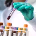 Japan Edges Closer to Medical Revolution with Universal Artificial Blood Development
