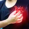 Cardiac Doctor Shares One Unusual Sign That Suggests You Might Be Having a Heart Attack