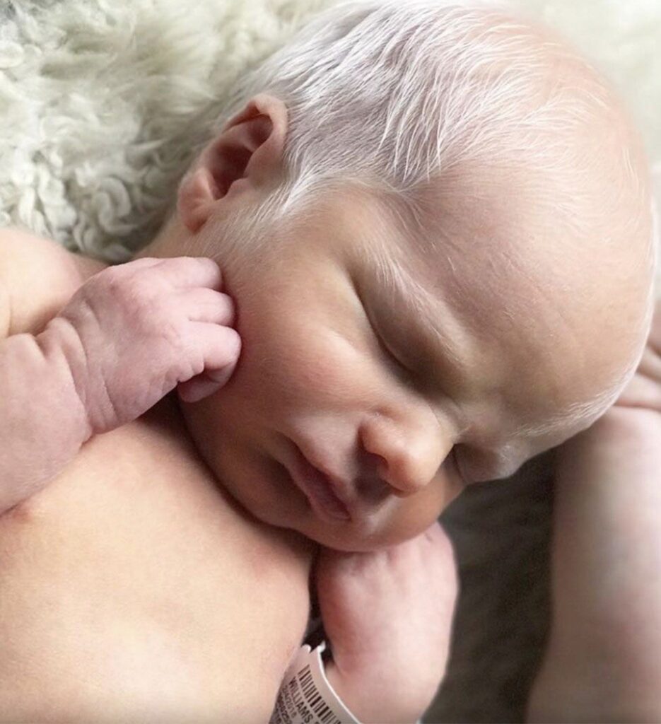 He was mocked online for his looks when he was born, They said he is born old, and looks like a grandpa, But wait till you see what he looks like now